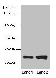 CSB-PA005008DA01HU