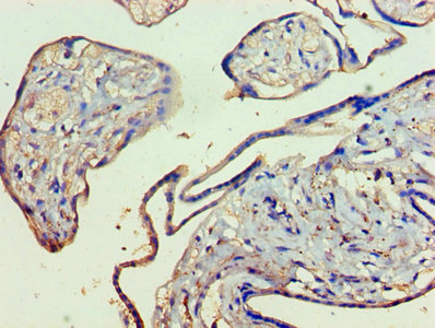 CSB-PA012475LA01HU