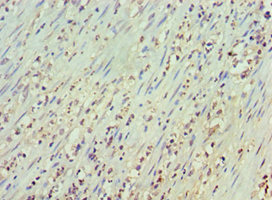 CSB-PA015007DSR2HU IHC
