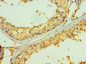 CSB-PA023971DSR2HU IHC2