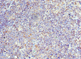 CSB-PA326953ESR1HU IHC-1