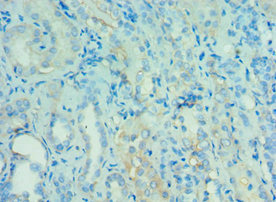 CSB-PA866314ESR2HU IHC1