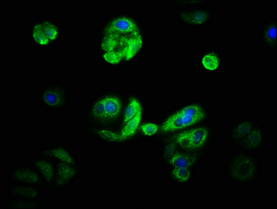 CSB-PA006400LA01HU
