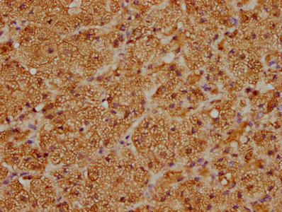 CSB-PA006400LA01HU