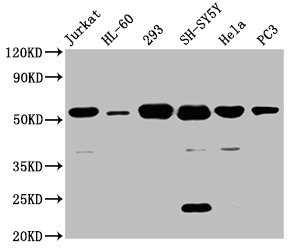 CSB-PA006400LA01HU