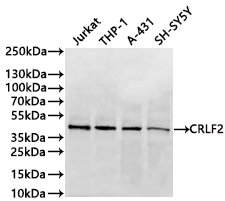 CSB-RA005983MA1HU WB