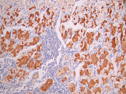 CSB-RA015215MA1HU IHC