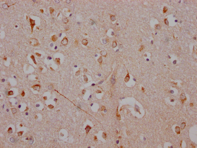CSB-RA224168A0HU