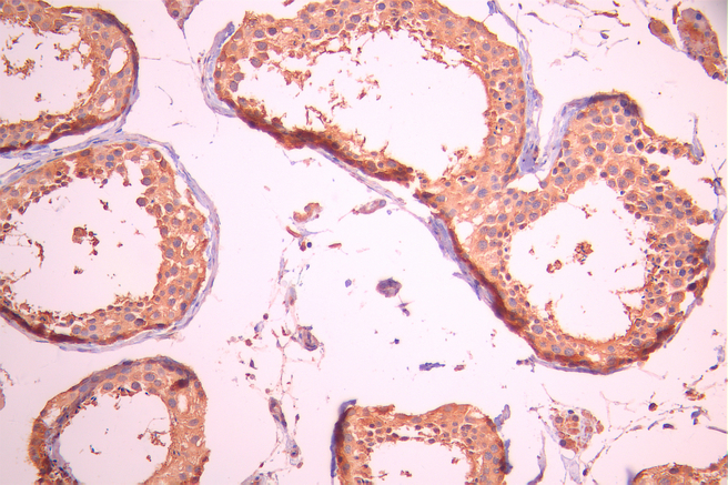 CSB-RA564844A0HU