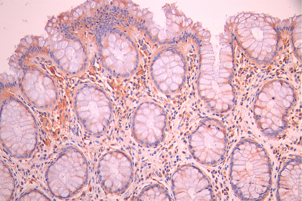 CSB-RA564844A0HU