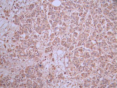 CSB-RA761623MA2HU IHC