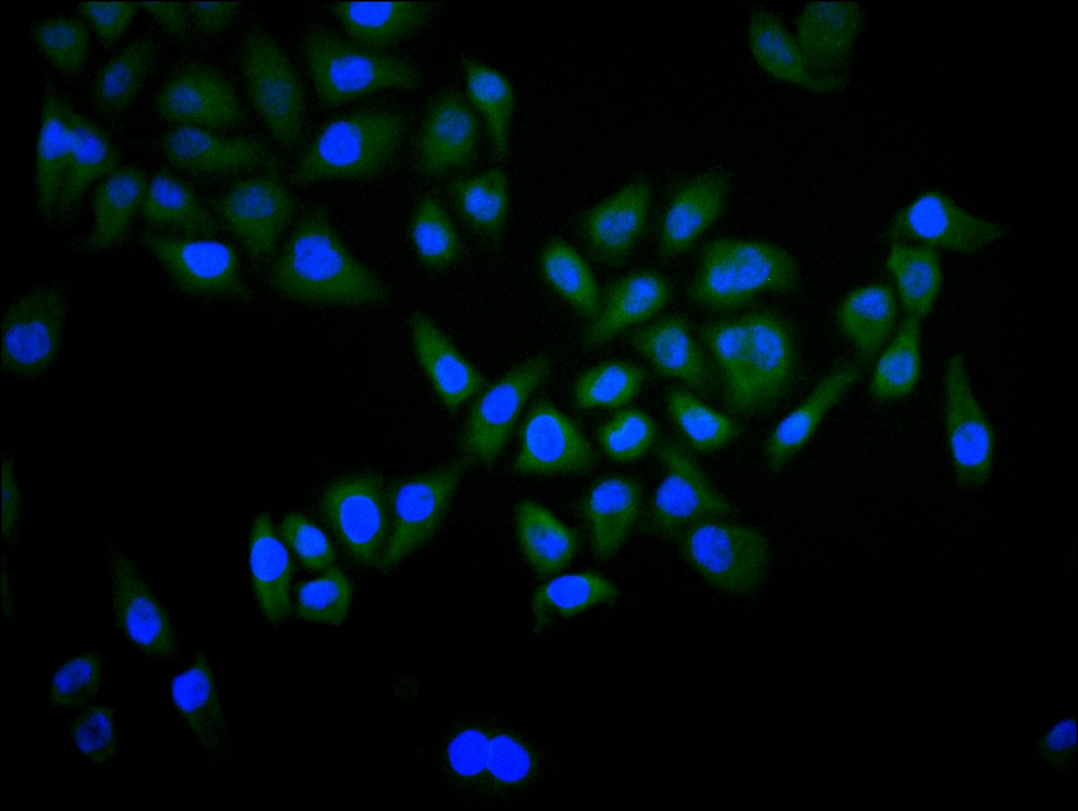 CSB-RA954261A0HU
