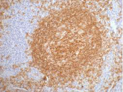 CSB-MA000204 IHC