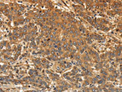 CSB-PA299262 IHC