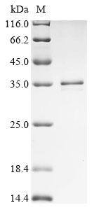 CSB-EP753710HU